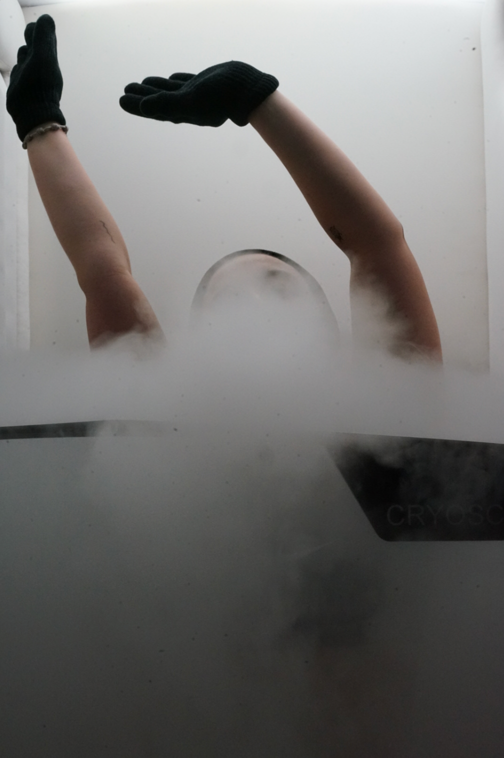 Cryotherapy: A New Level of Chill